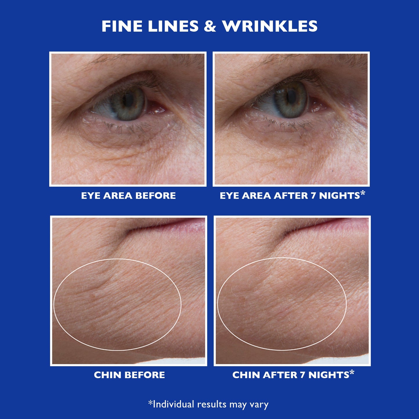 Retinol Fusion PM Night Serum|1.0 fl oz